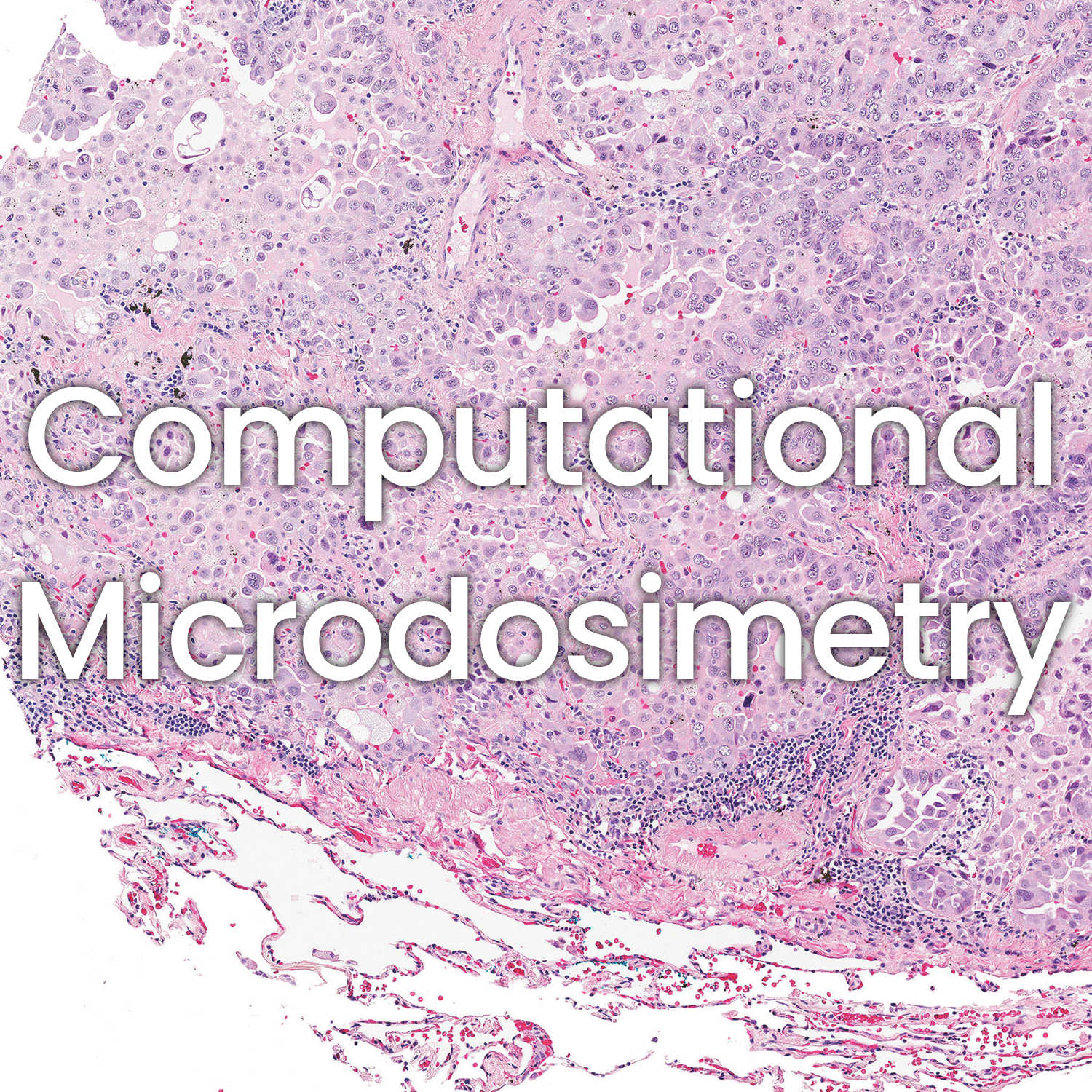 Microdosimetry